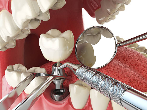 Best Emergency Root Canal Treatment in St Pauls, NC